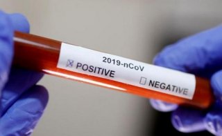 Еще 771 житель Днепропетровщины заболел коронавирусом - ФОТО