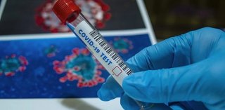 В Каменском коронавирусом заболели 134 человека - ФОТО