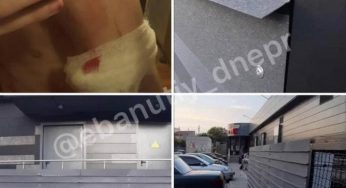 В Днепре возле магазина АТБ мальчик порезался о кондиционер
