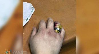 В Днепре трое спасателей снимали кольцо с пальца молодого парня