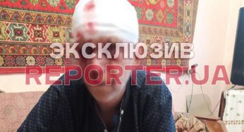 В Днепре отец избил сына и пытался застрелить